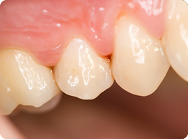 歯科の治癒促進効果